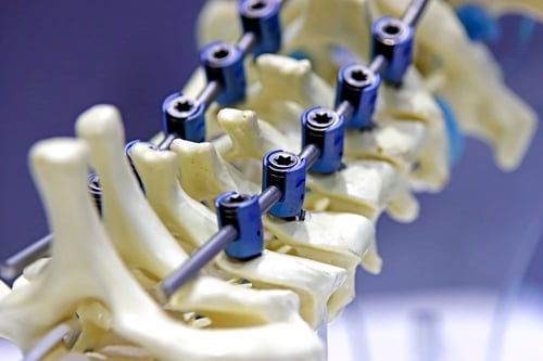 Image of orthopedic device